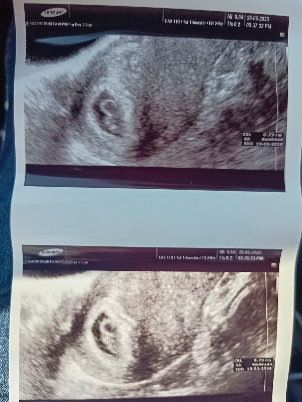First Heartbeat Picture